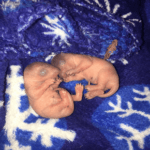 Wildlife Rehab Just Born Baby Opossums - Help4Wildlife in Dexter, MI